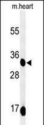 COQ9 Antibody in Western Blot (WB)