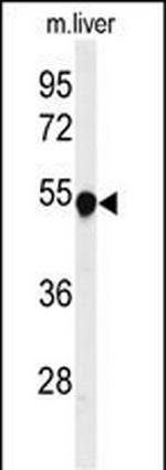 PAH Antibody in Western Blot (WB)