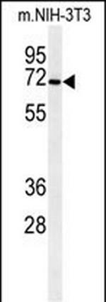 CSGALNACT1 Antibody in Western Blot (WB)