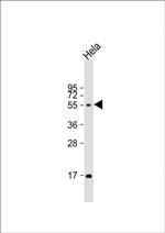 FUT6 Antibody in Western Blot (WB)