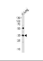 MFAP4 Antibody in Western Blot (WB)