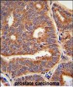 PTPLB Antibody in Immunohistochemistry (Paraffin) (IHC (P))