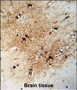 FABP7 Antibody in Immunohistochemistry (Paraffin) (IHC (P))