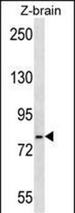 GRP78 Antibody in Western Blot (WB)