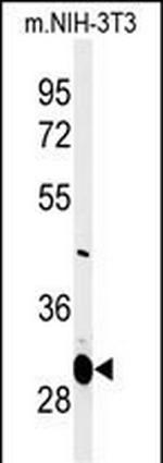 MAGT1 Antibody in Western Blot (WB)