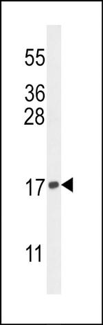 H3K9me2 Antibody in Western Blot (WB)