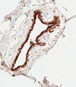 S100B Antibody in Immunohistochemistry (Paraffin) (IHC (P))