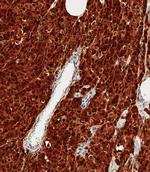 S100B Antibody in Immunohistochemistry (Paraffin) (IHC (P))