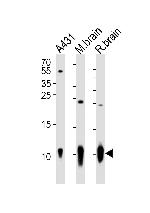 S100B Antibody in Western Blot (WB)