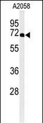 Ku70 Antibody in Western Blot (WB)