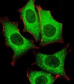 GLD2 Antibody in Immunocytochemistry (ICC/IF)