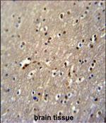 GLD2 Antibody in Immunohistochemistry (Paraffin) (IHC (P))