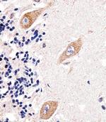 GLD2 Antibody in Immunohistochemistry (Paraffin) (IHC (P))