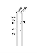 GLD2 Antibody in Western Blot (WB)