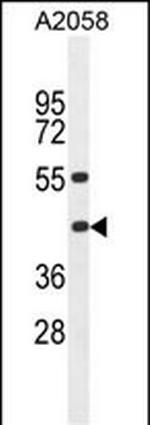 HLA-B Antibody in Western Blot (WB)