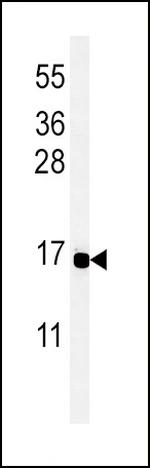 PYY Antibody in Western Blot (WB)