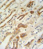 ZFYVE16 Antibody in Immunohistochemistry (Paraffin) (IHC (P))