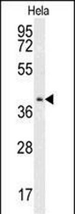 CMPK2 Antibody in Western Blot (WB)