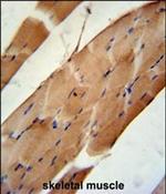 CNOT6L Antibody in Immunohistochemistry (Paraffin) (IHC (P))