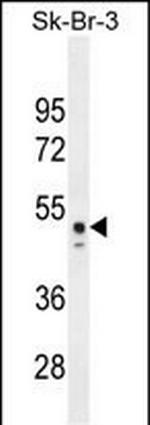 CNOT6L Antibody in Western Blot (WB)