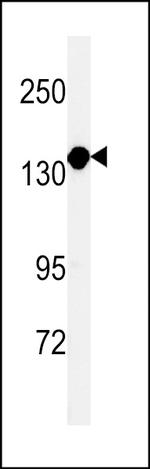 MTMR15 Antibody in Western Blot (WB)