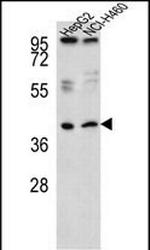 RSAD1 Antibody in Western Blot (WB)