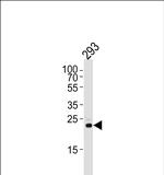 RSPO2 Antibody in Western Blot (WB)