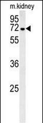 GNE Antibody in Western Blot (WB)