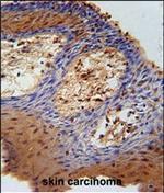 DHRS2 Antibody in Immunohistochemistry (Paraffin) (IHC (P))