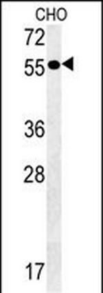 Pancreatic Amylase Antibody in Western Blot (WB)