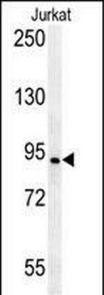 AXIN2 Antibody in Western Blot (WB)