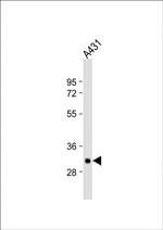 Tryptase Antibody in Western Blot (WB)