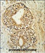 ATP11C Antibody in Immunohistochemistry (Paraffin) (IHC (P))