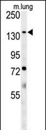 ATP11C Antibody in Western Blot (WB)