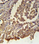 MC2R Antibody in Immunohistochemistry (Paraffin) (IHC (P))