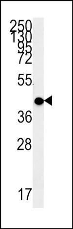 MC2R Antibody in Western Blot (WB)