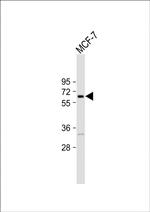 FBXO9 Antibody in Western Blot (WB)