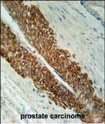 STEAP2 Antibody in Immunohistochemistry (Paraffin) (IHC (P))