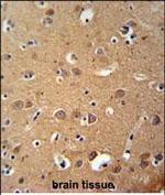 ZDHHC2 Antibody in Immunohistochemistry (Paraffin) (IHC (P))