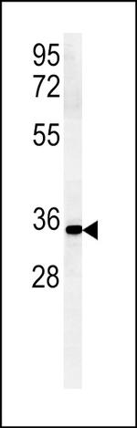 ZDHHC2 Antibody in Western Blot (WB)