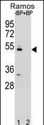 ZDHHC2 Antibody in Western Blot (WB)