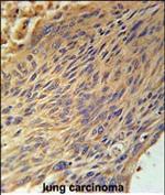 CPEB4 Antibody in Immunohistochemistry (Paraffin) (IHC (P))