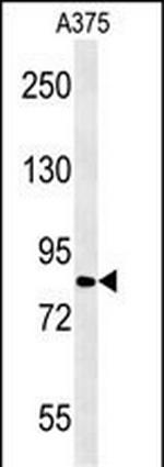 CPEB4 Antibody in Western Blot (WB)