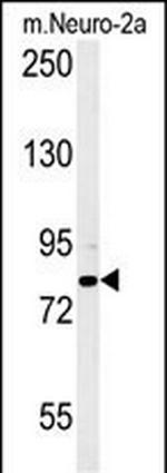 CPEB4 Antibody in Western Blot (WB)