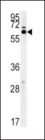 IKZF3 Antibody in Western Blot (WB)