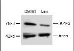 IKZF3 Antibody in Western Blot (WB)