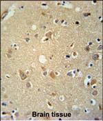 P2X7 Antibody in Immunohistochemistry (Paraffin) (IHC (P))