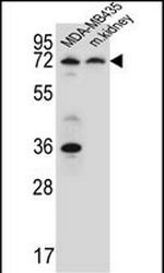 P2X7 Antibody in Western Blot (WB)