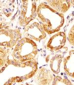 HAS2 Antibody in Immunohistochemistry (Paraffin) (IHC (P))