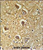 HAS2 Antibody in Immunohistochemistry (Paraffin) (IHC (P))